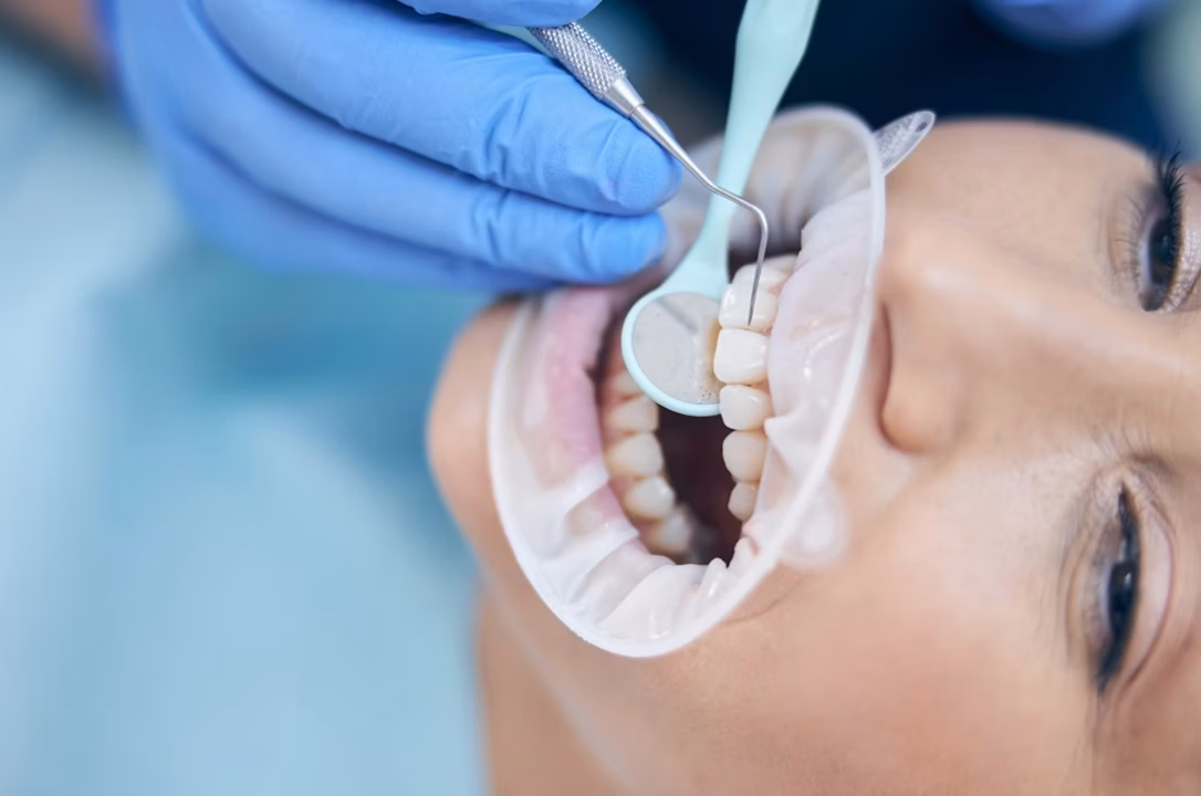 Dentistes à Castres : trouver votre praticien